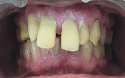Dental Before