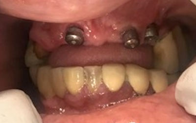 teeth before venkateshwarhospitals dwarka 