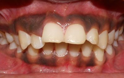 venkateshwarhospitals treatment