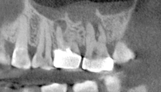 Sinus Image PA & Lat