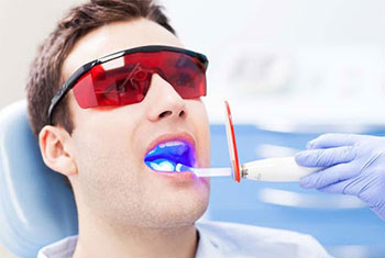 Laser Root Canal Treatment